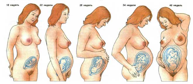 может ли икота быть признаком беременности
